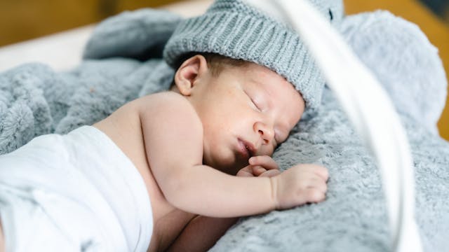 Phân biệt chàm sữa và mẫn cảm