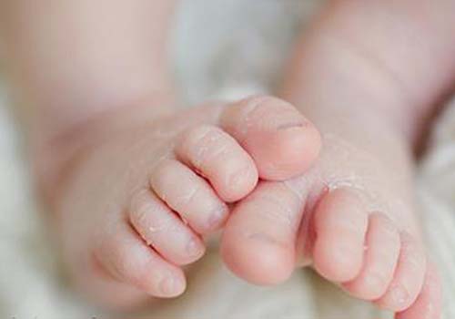 Phòng dị ứng da cho bé